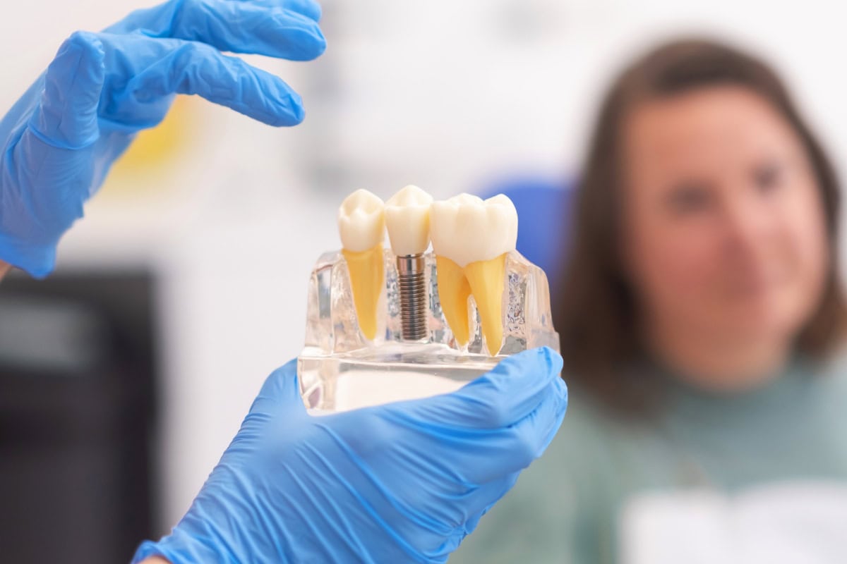 Does Getting Dental Implants Hurt? Dispelling Myths by Dr. Niki Johnston