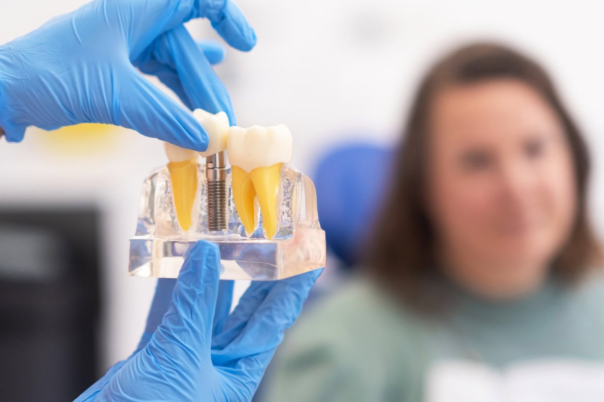 When Do You Need Bone Grafting for Dental Implants: Dr. Geoffrey Johnston Explains
